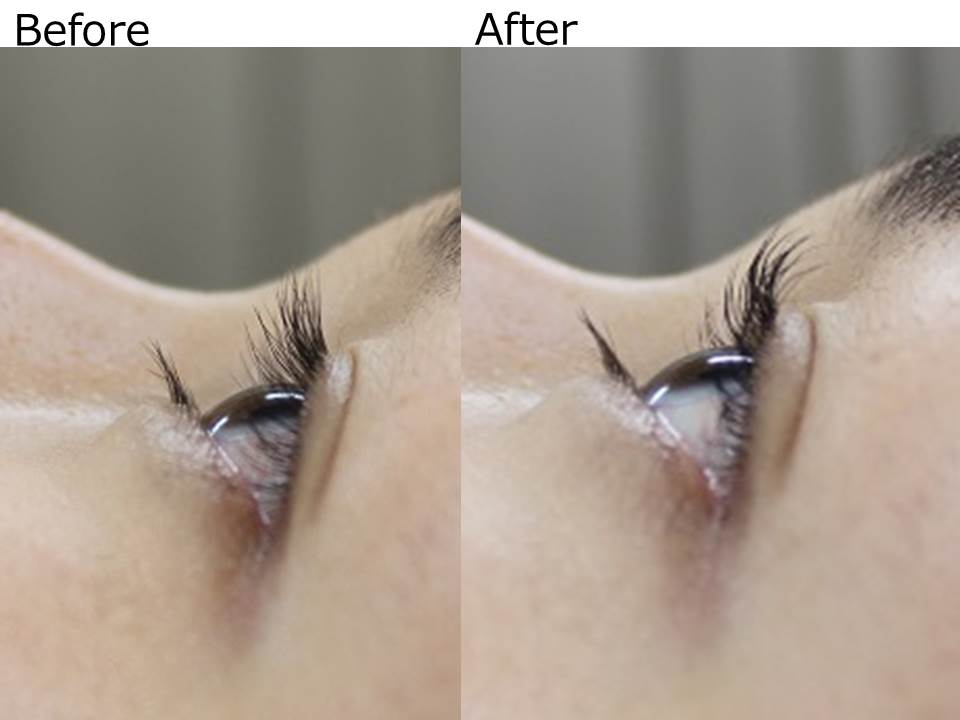 まつ毛　Before　After