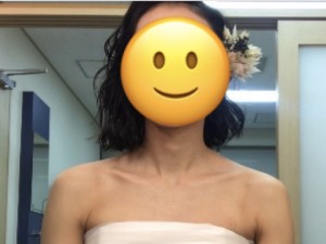 結婚式　after
