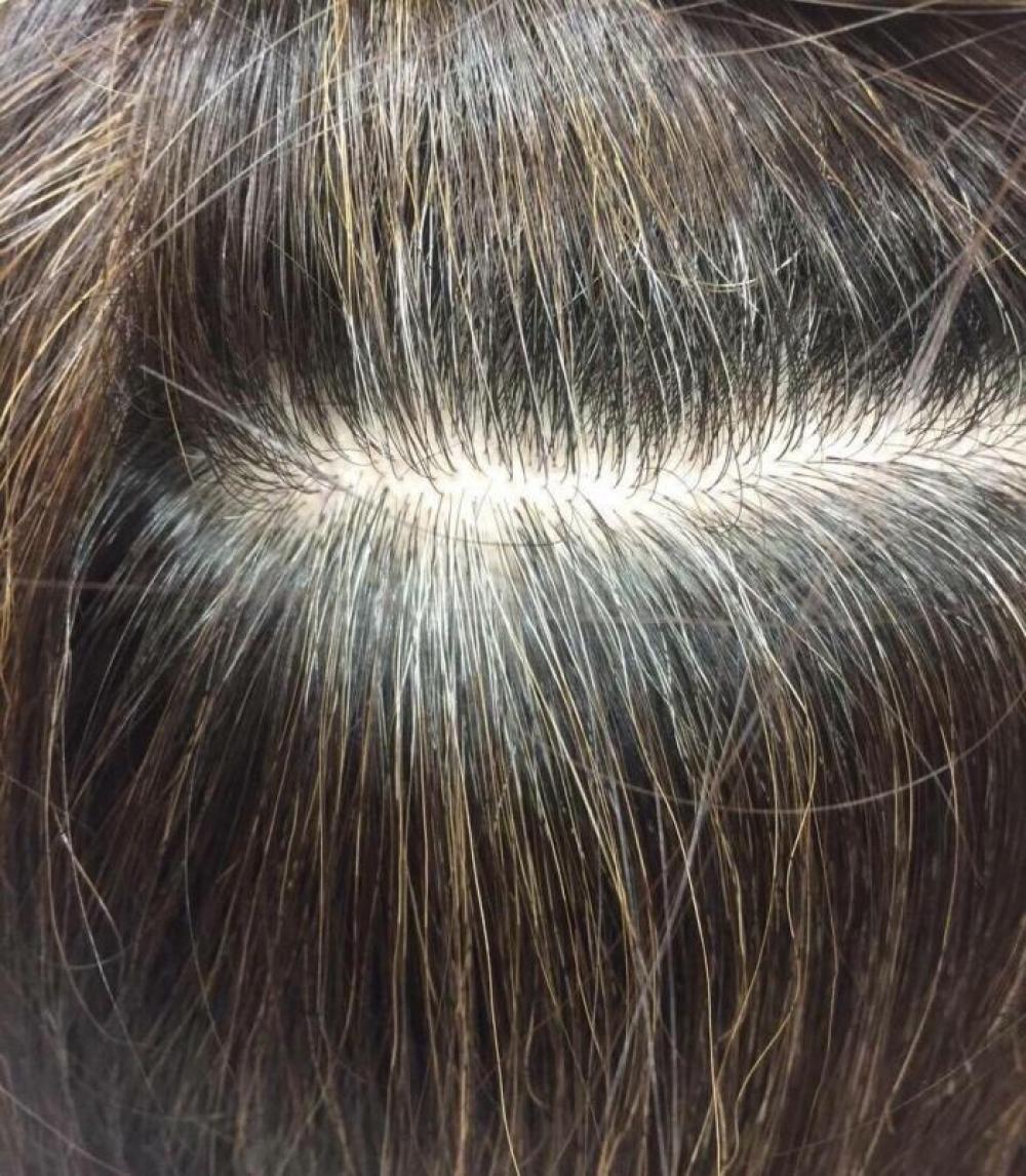 アドジュネスを使う前の写真