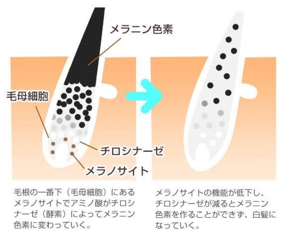 実はもともとは白い髪な人類！メラニンの違いだった！！