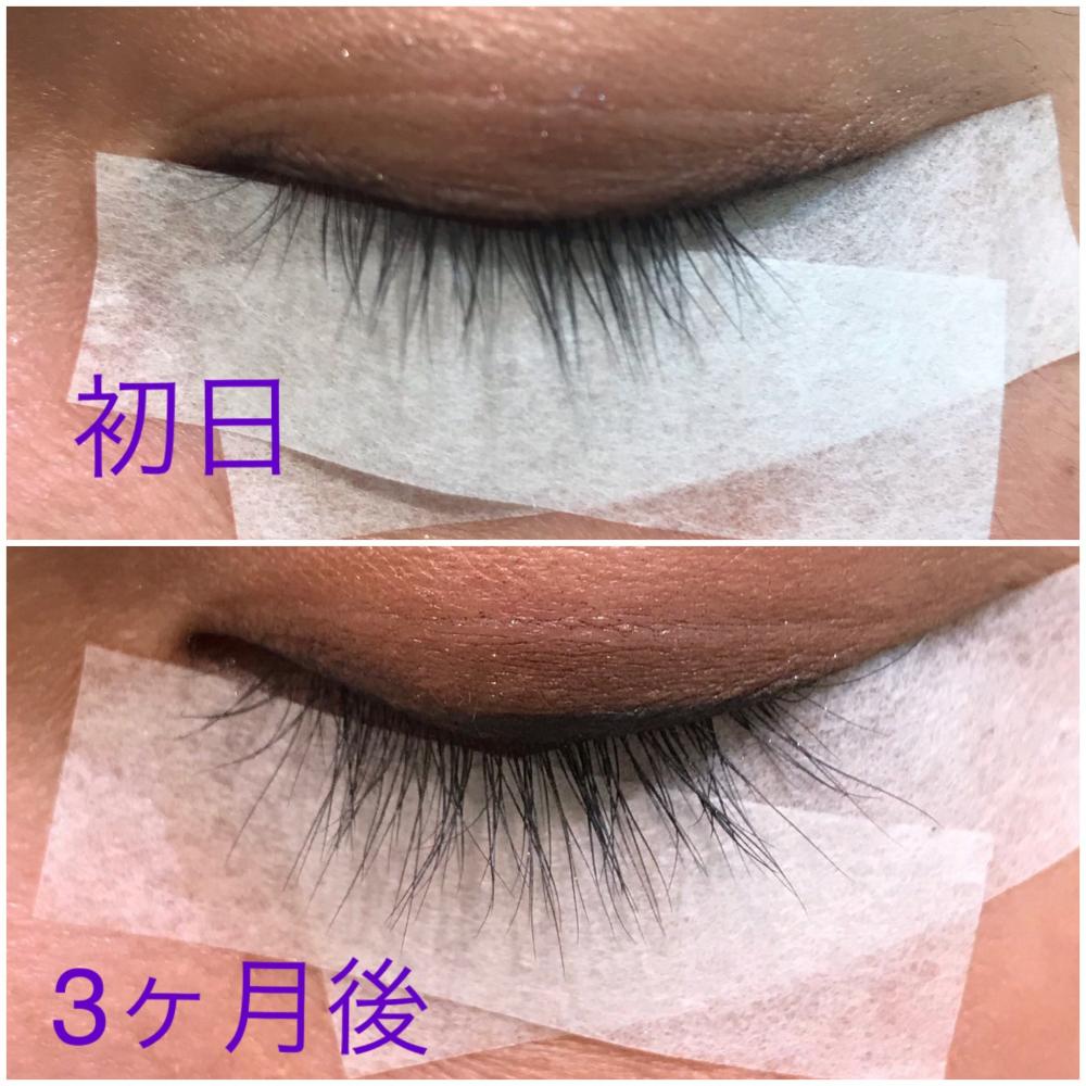 追加☆3ヶ月後の効果！！