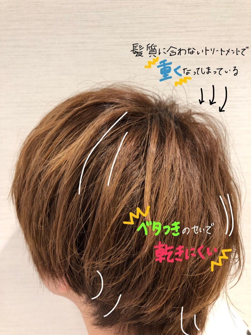 『トリートメントの失敗例』