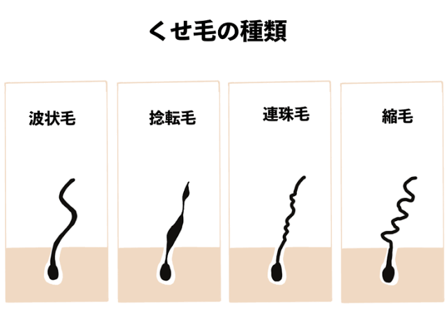 どんな【癖毛】でも大丈夫なの？