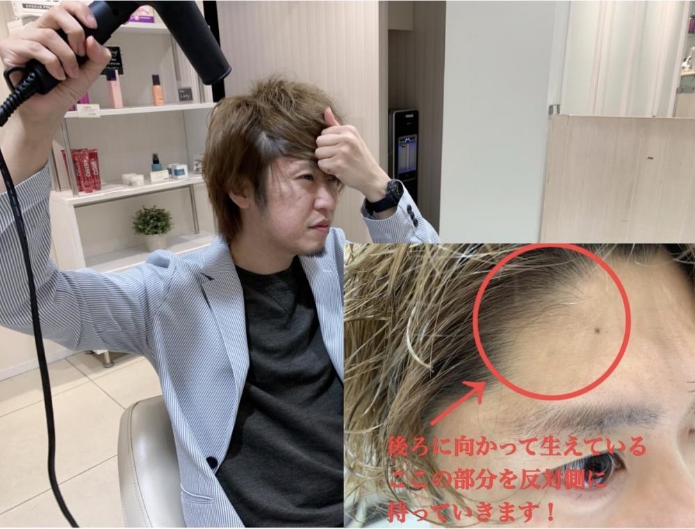 顔回りの天敵！生え癖は反対方向に！！