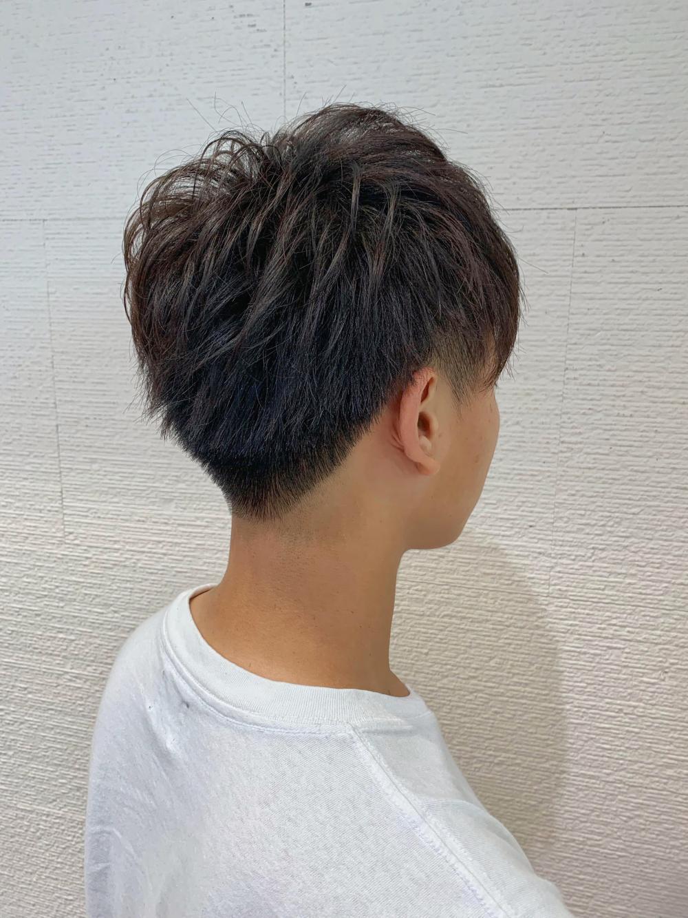 【それでも気になる方にオススメの施術】