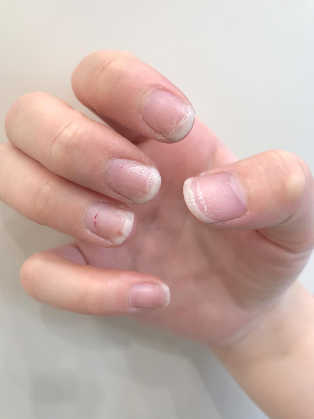 やってはいけない‼ジェルを無理やりはがす。