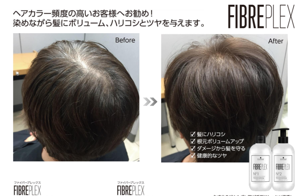 Before　After　その１