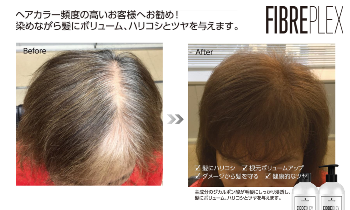 Before　After　その２