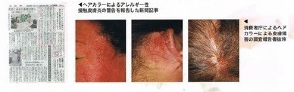 頭皮や髪に深刻なダメージを与える原因は・・・