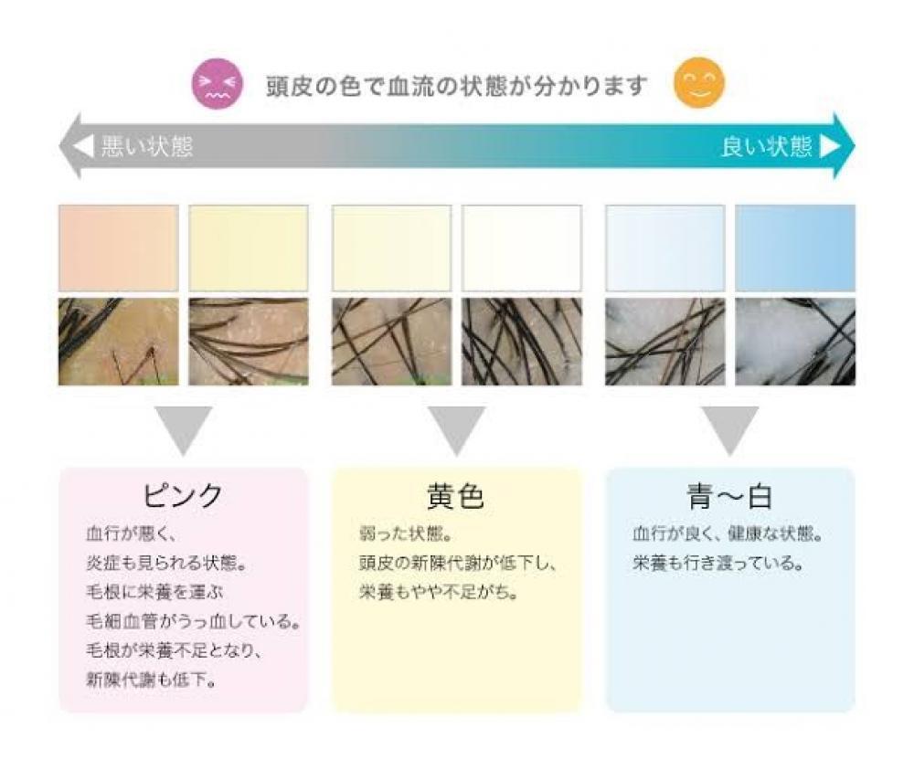 チェック！！頭皮の色や感触☆