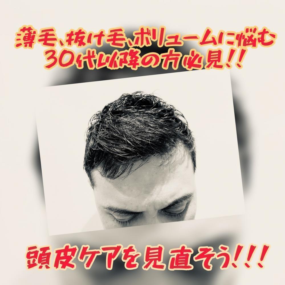 30代以降の薄毛、抜け毛、白髪、ボリューム。。と増える悩み。まずは頭皮ケアからはじめよう！！