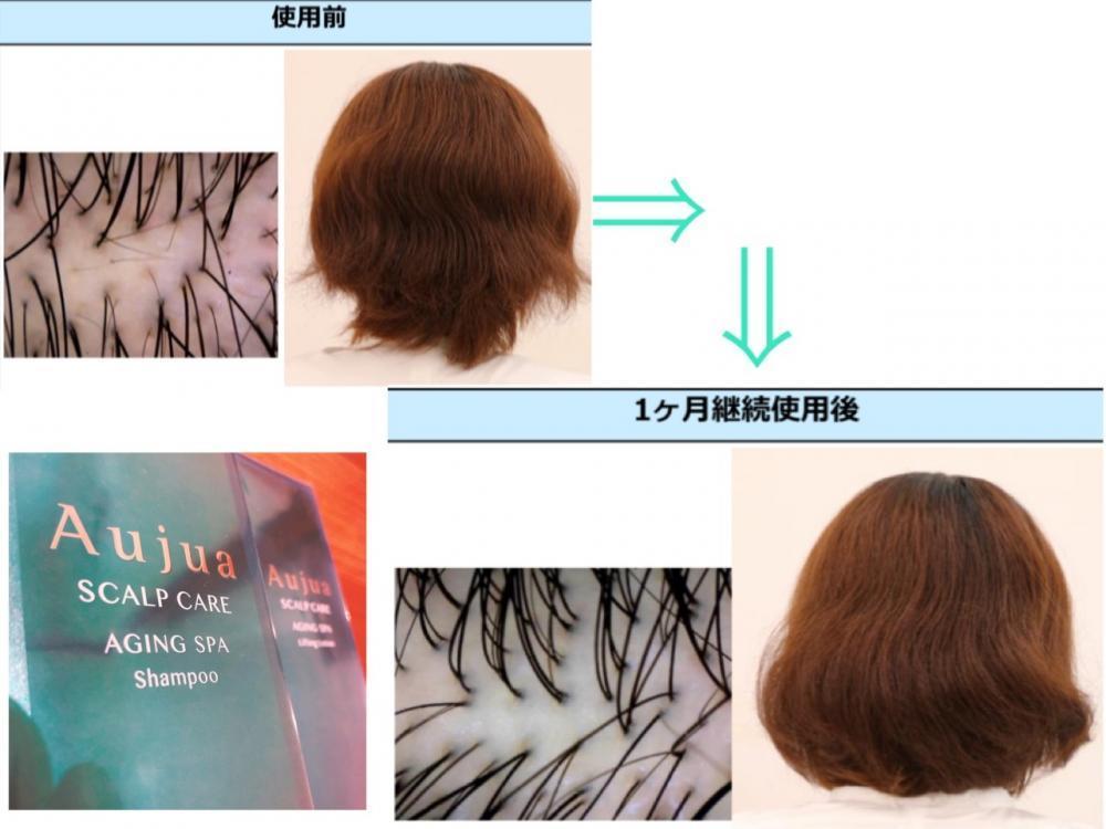 【AGING SPA/エイジングスパ　でボリュームアップ！】