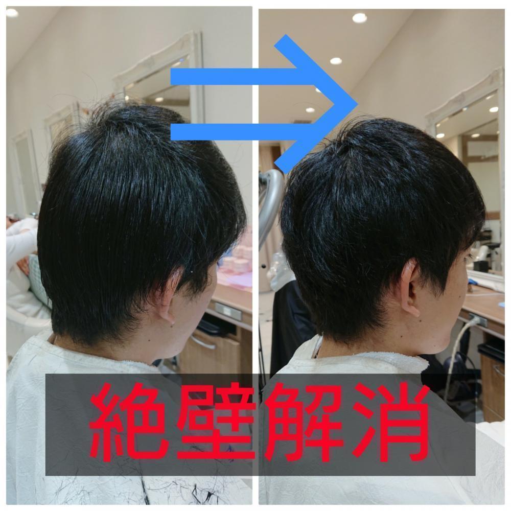 後頭部が平ら。いわゆる「絶壁」を解消する。