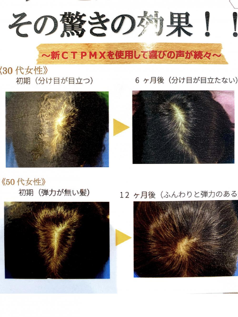 なぜクオレサイトプラインMXが日本一なのか