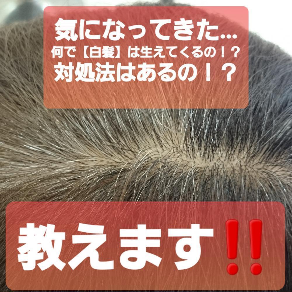 気になってきた…【白髪】！何で白髪が生えてくる？？