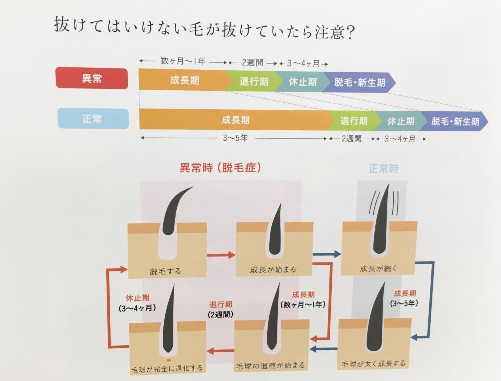 抜けてはいけない毛が抜けていたら注意？