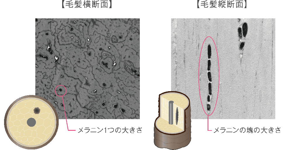 メラニンクラックの発見