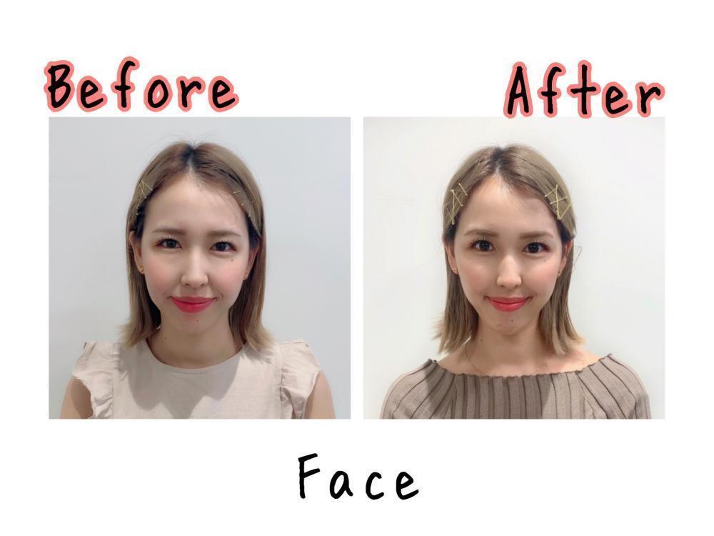 顔　ビフォアー　アフター