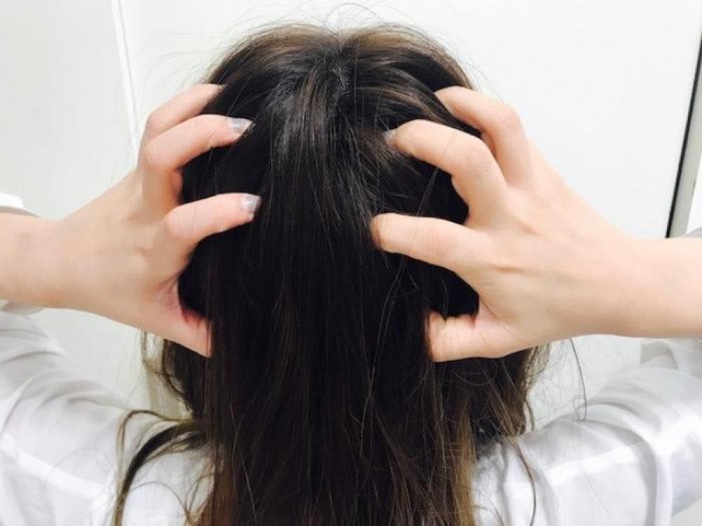 抜け毛