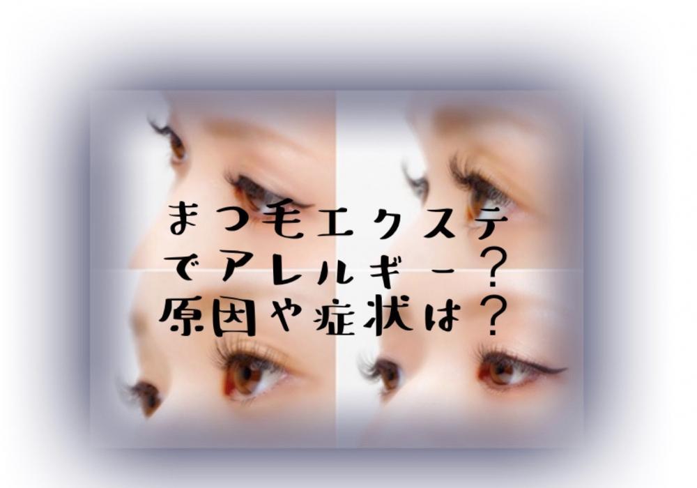 まつ毛エクステでアレルギー？原因や症状は？