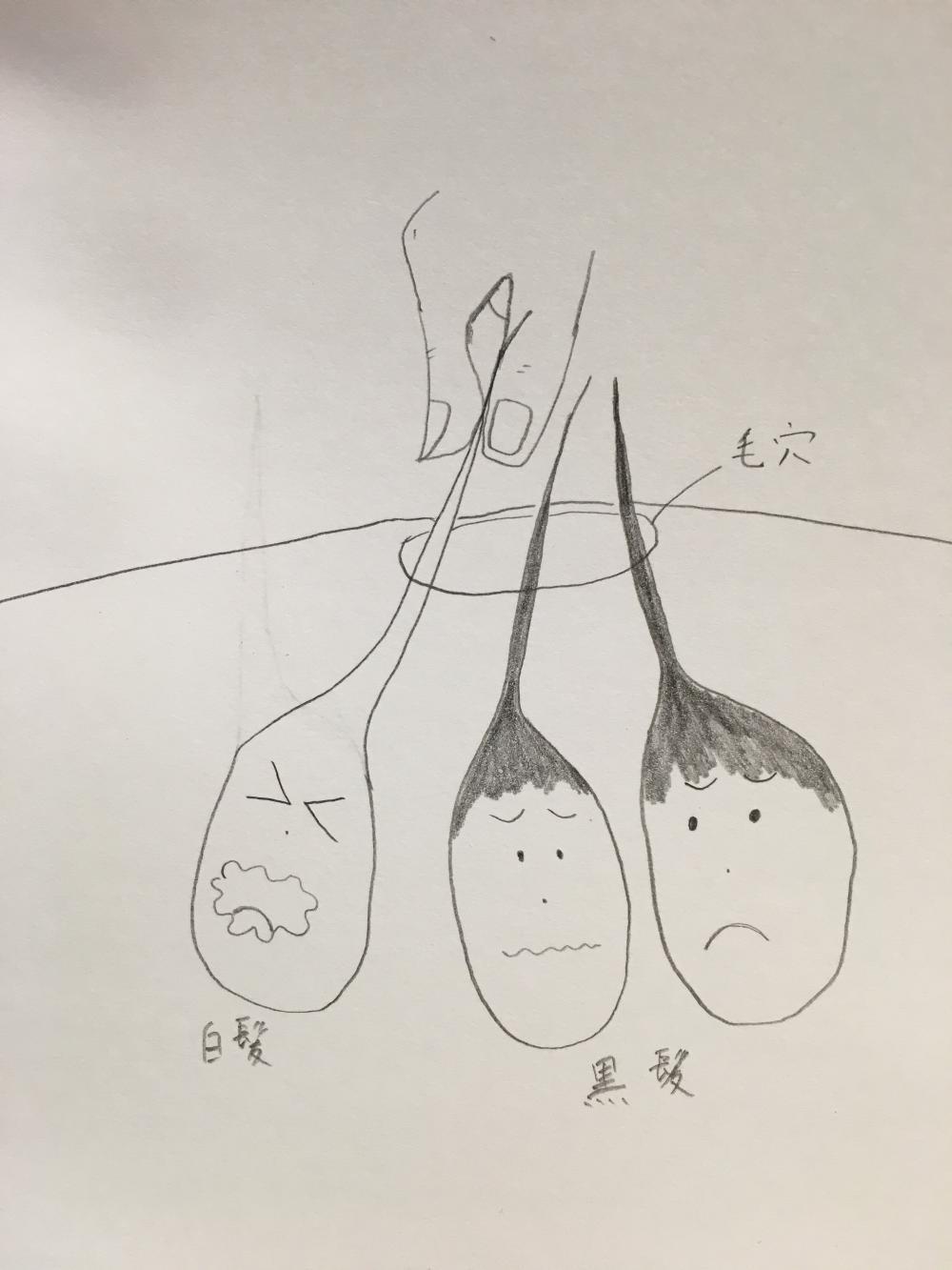 白髪を抜くとどうなるのか？？①