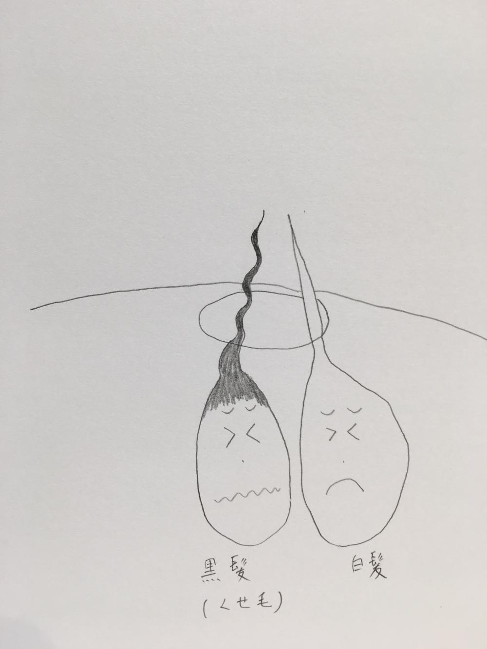 白髪を抜くとどうなるのか？？②