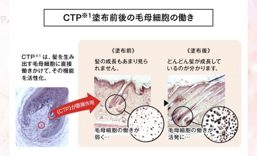 抜け毛、脱毛の原因はなあに⁉️