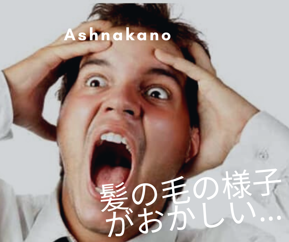 冬になり薄毛を気になる⁈ 薄毛になる4つの理由…