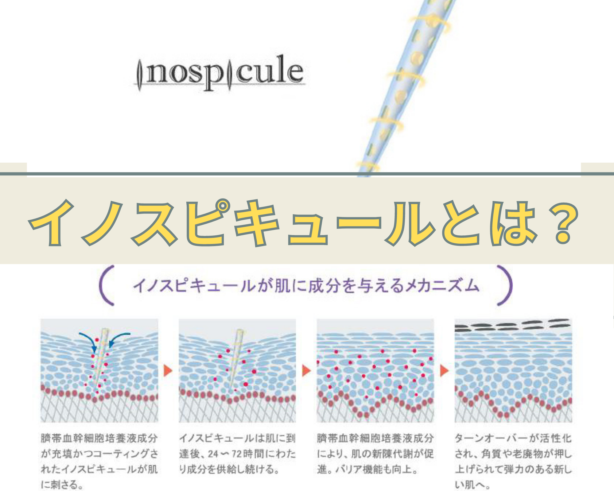 イノスピキュールとは？詳しく解説します！