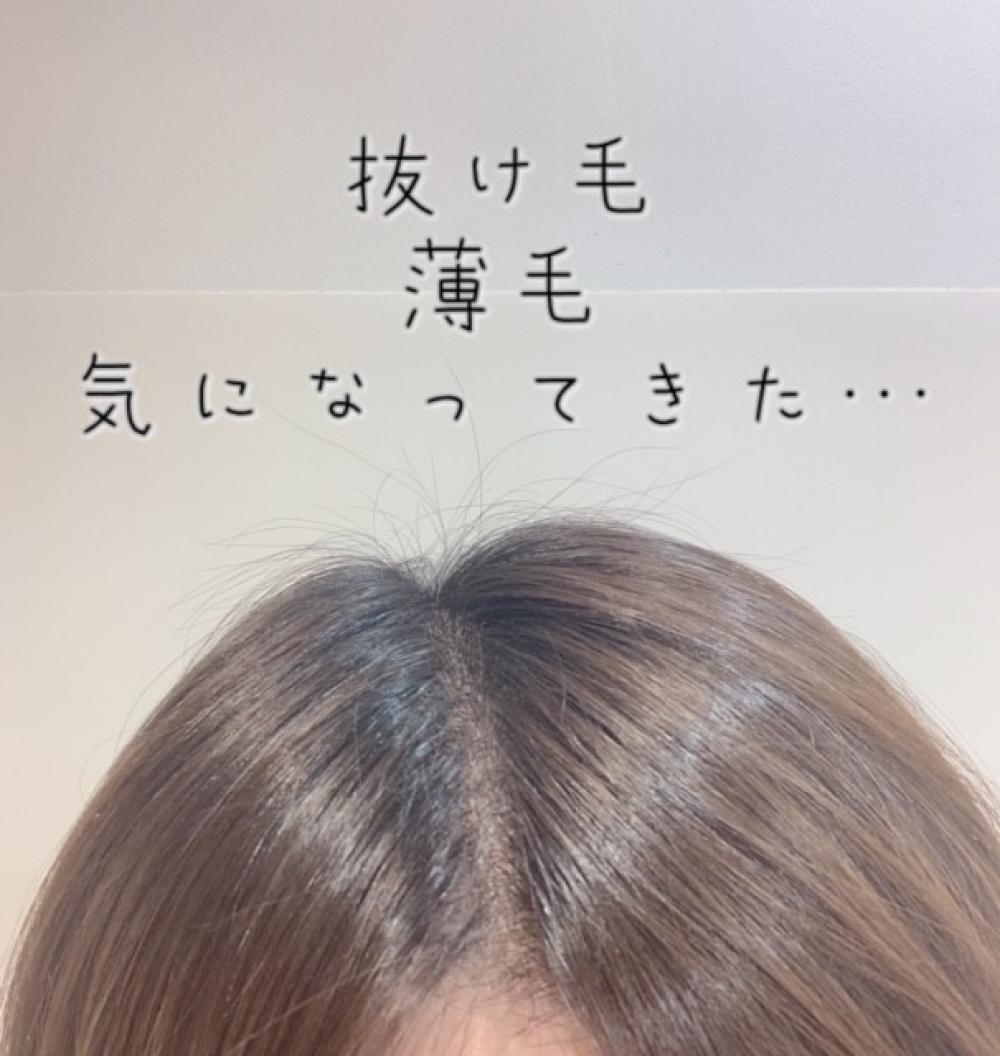 抜け毛、薄毛が気になる方必見！
