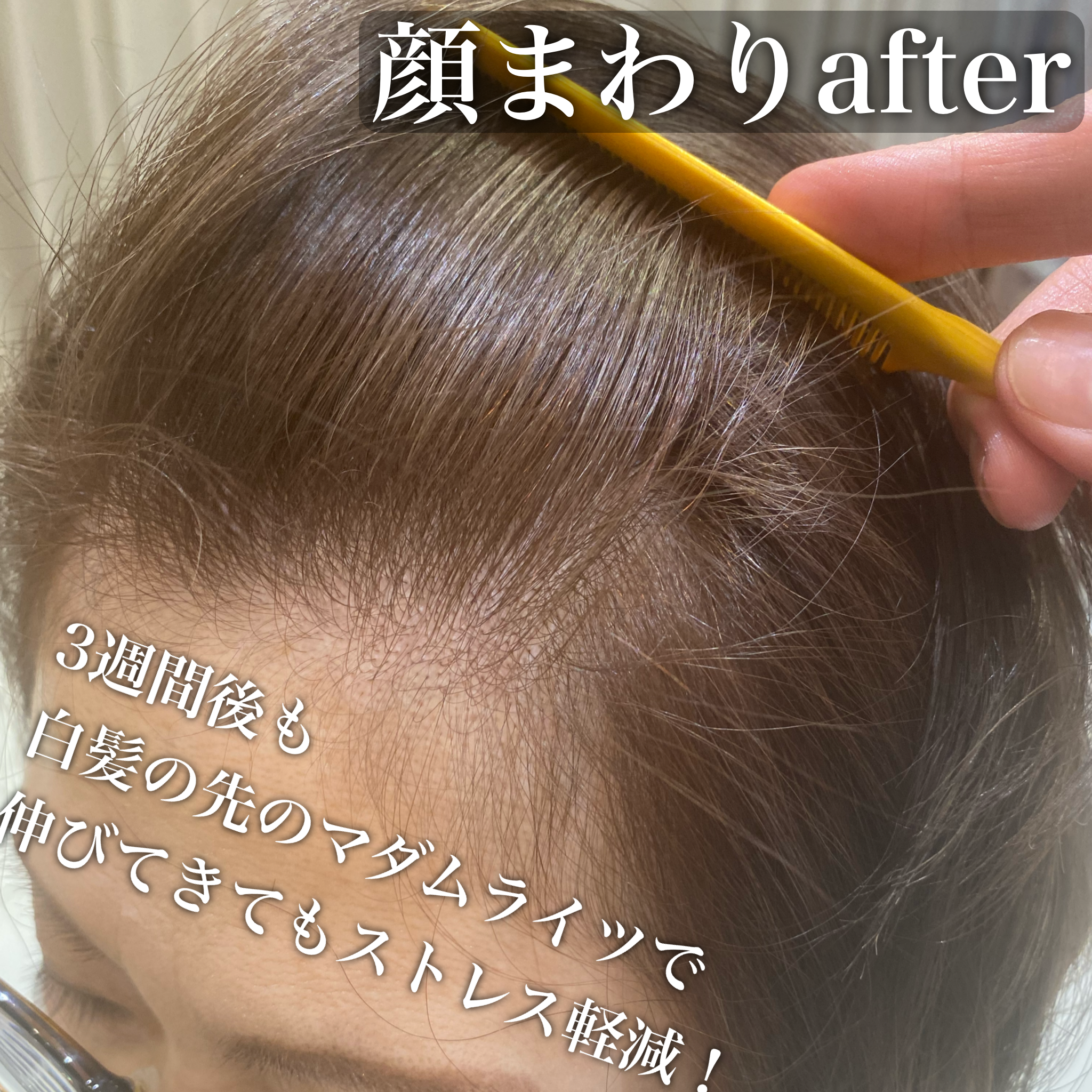 顔まわりafter