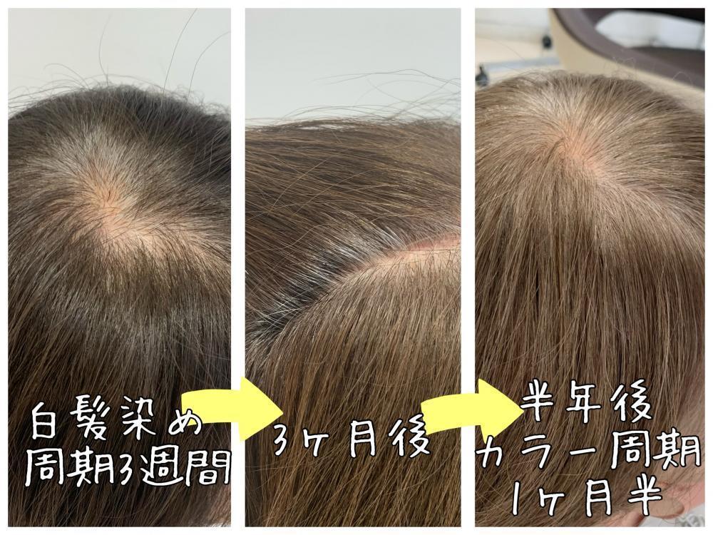 白髪ぼかしを開始した半年後