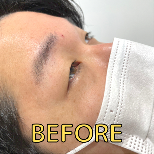 ビフォアーはこんな感じです。