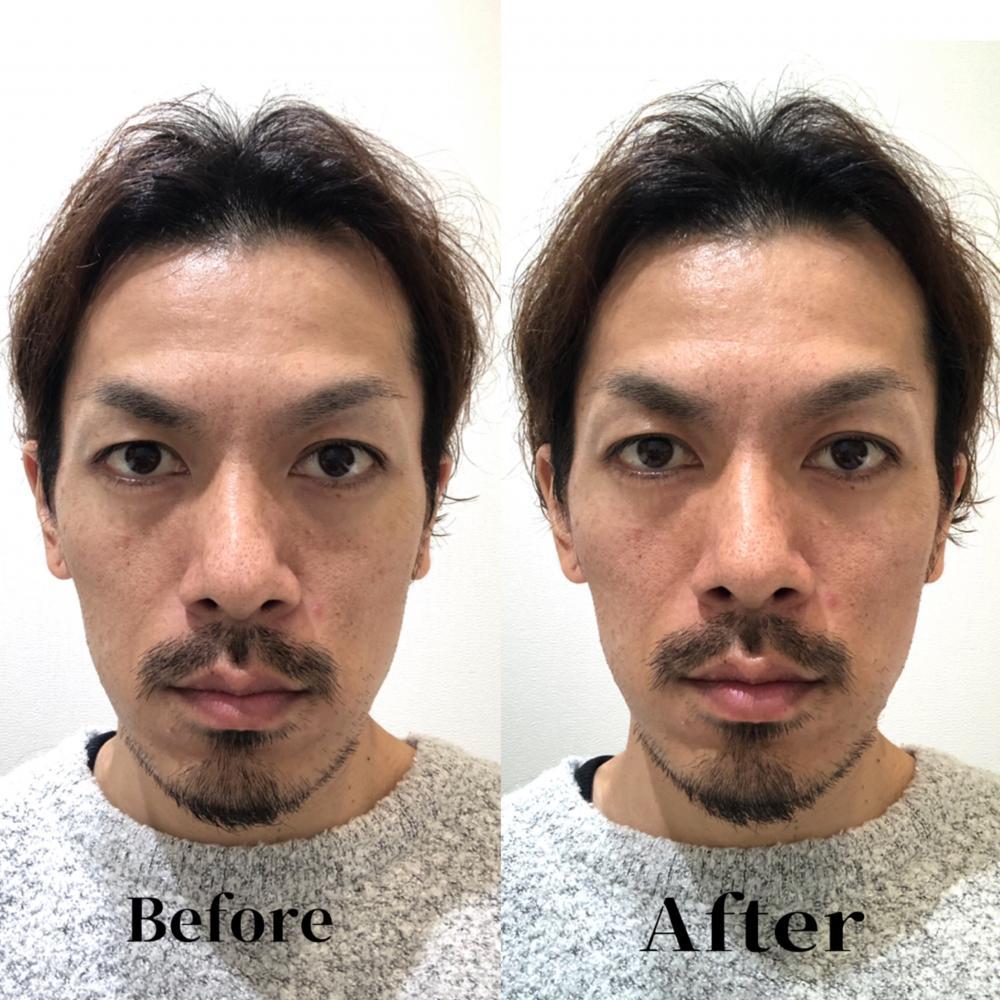 お肌のメリットは4個