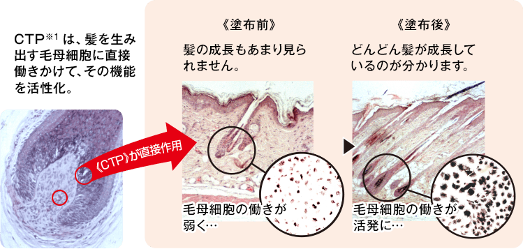 成分の『CTP』と『C-17』って何？？