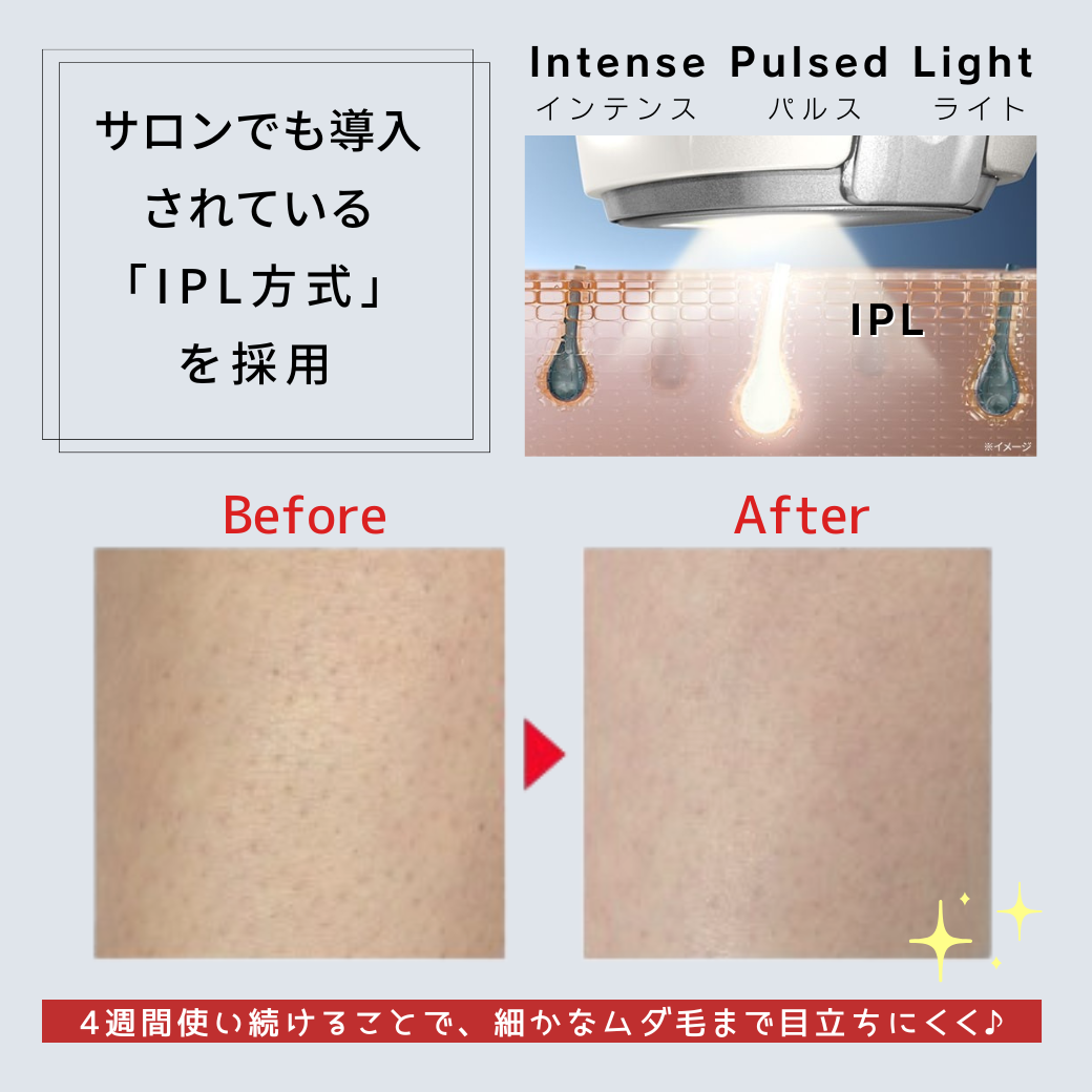 【IPLによる美肌効果】サロンでも導入されている『IPL方式』を採用