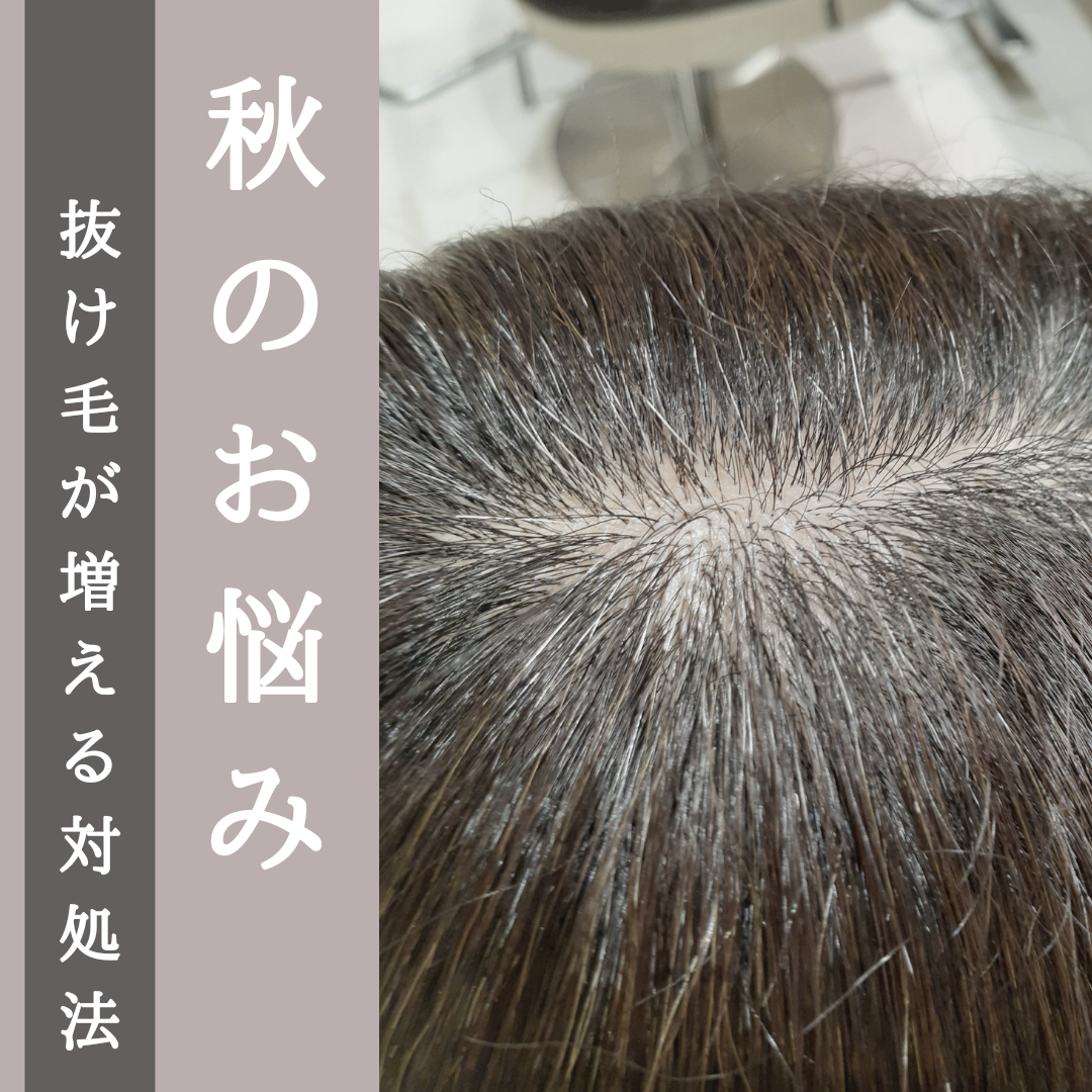 秋のお悩み【抜け毛が増える】３つの対処法！