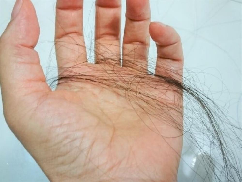 秋になると抜け毛が気になるのはなぜ？