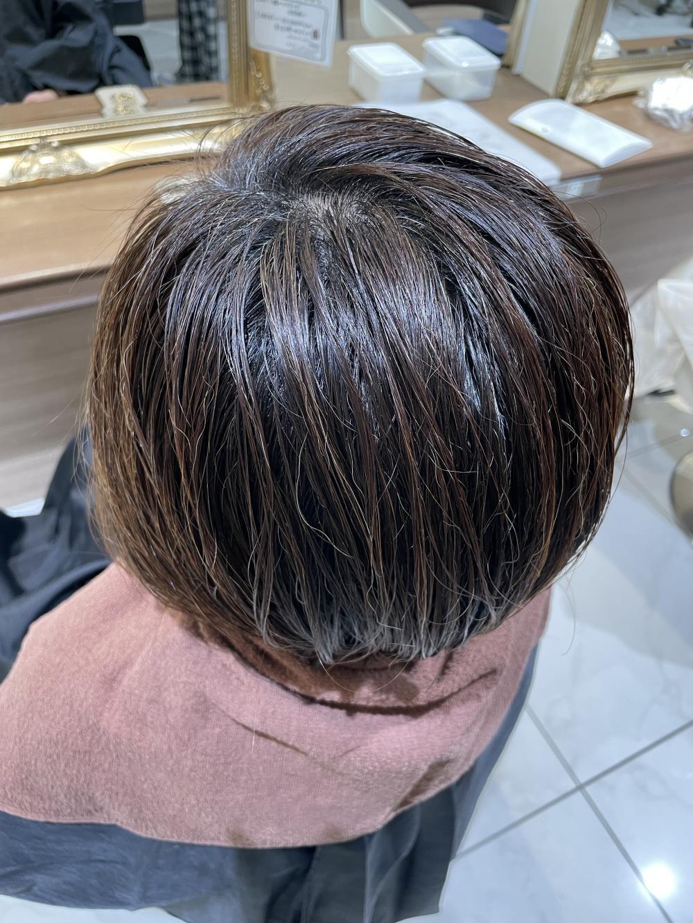 こちらは施術前の写真です。