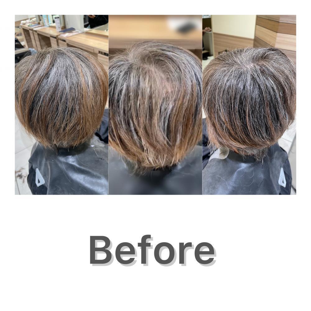 施術前の写真。白髪率は５０％ほど