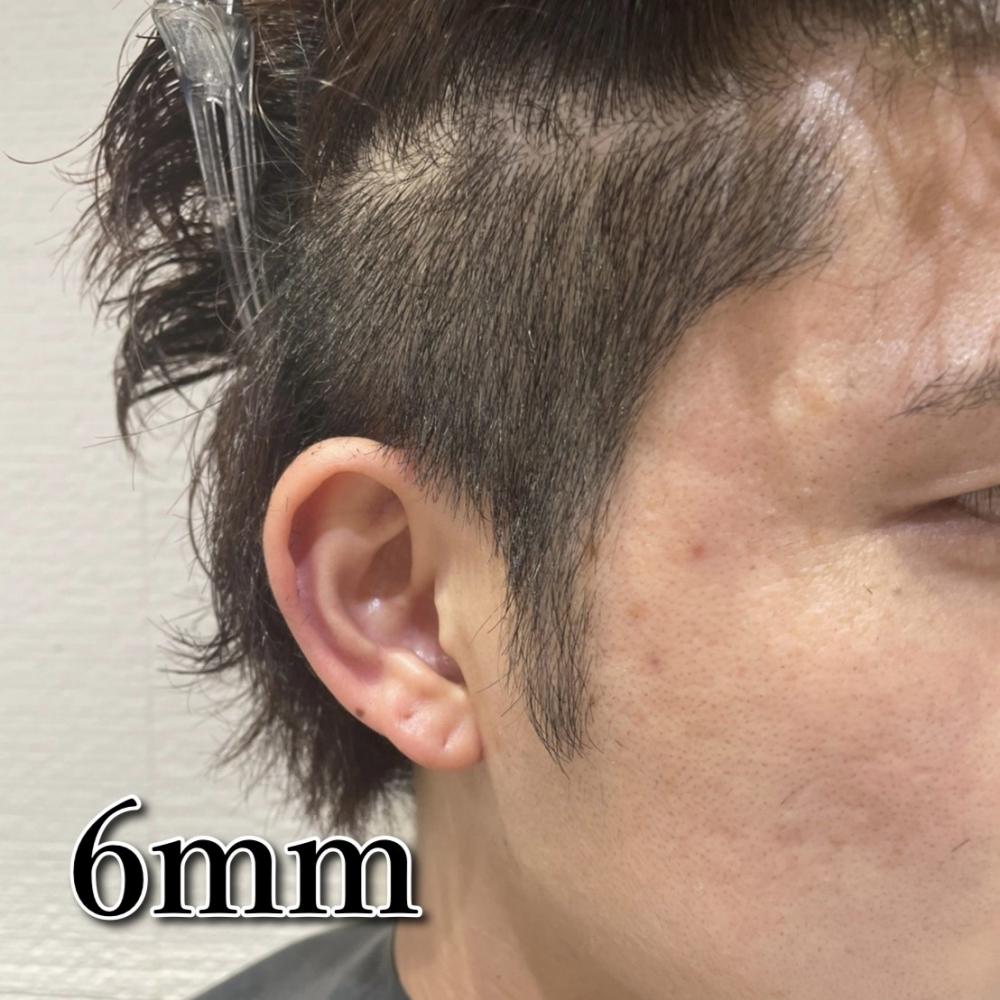 4〜6mm