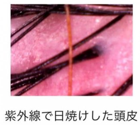 夏のダメージは秋まで続く！？
