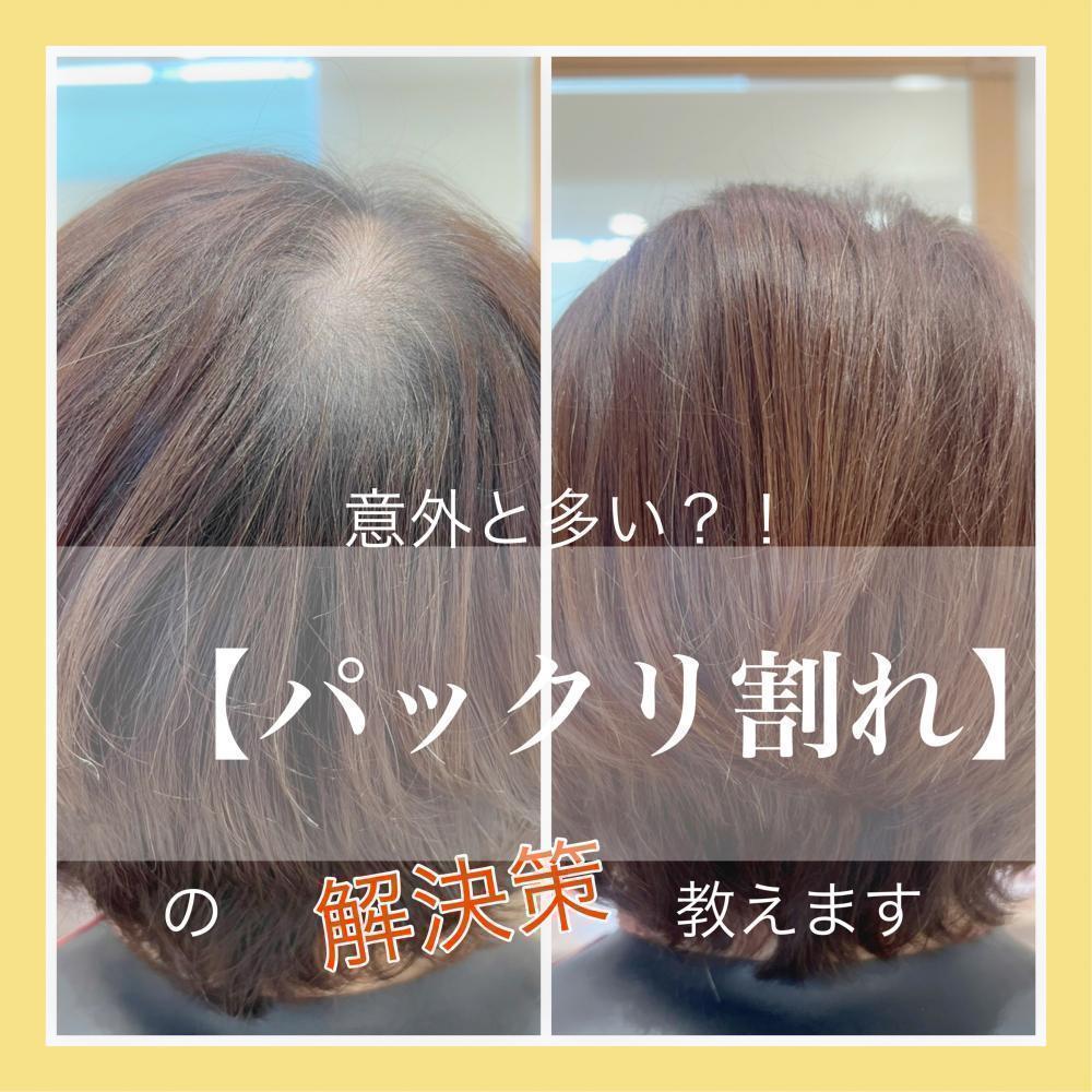 まだ『パックリ割れ』に悩んでるの？！つむじ、前髪のお悩み解決！！