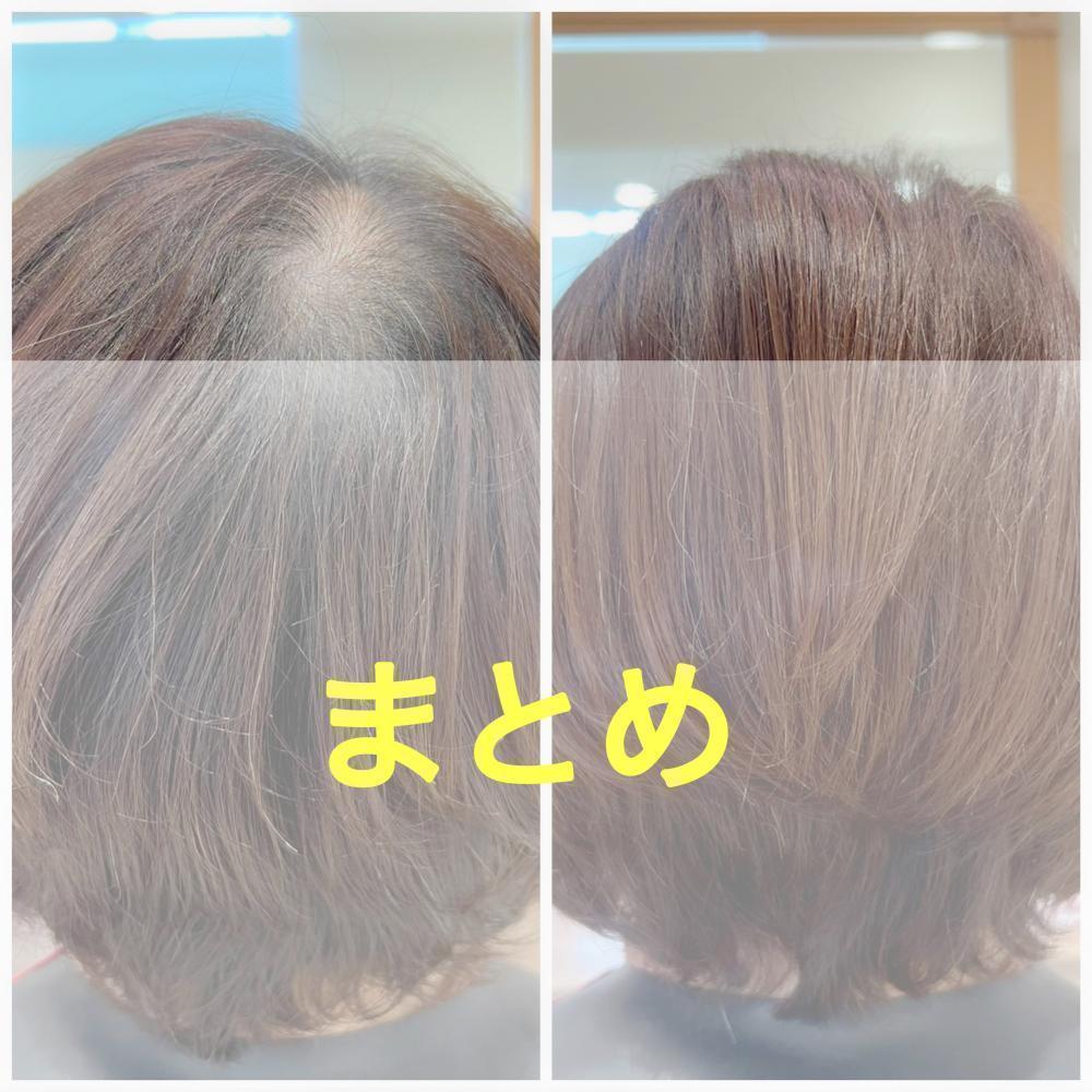 まとめ