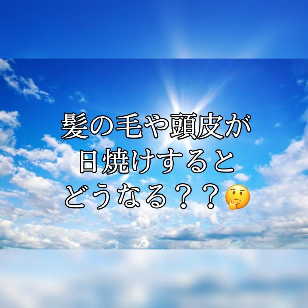 髪や頭皮が日焼けすると、、