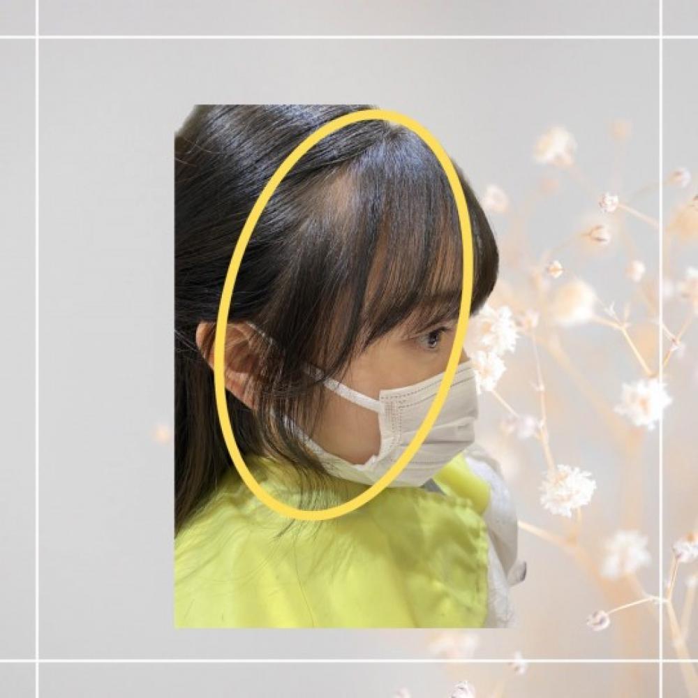 超小顔効果！？『顔周りレイヤー』