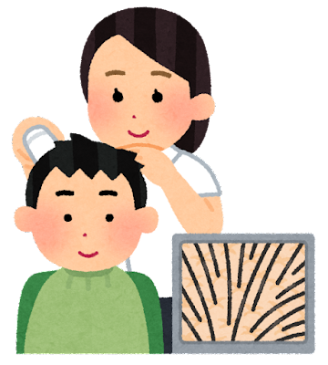 頭皮の日焼け