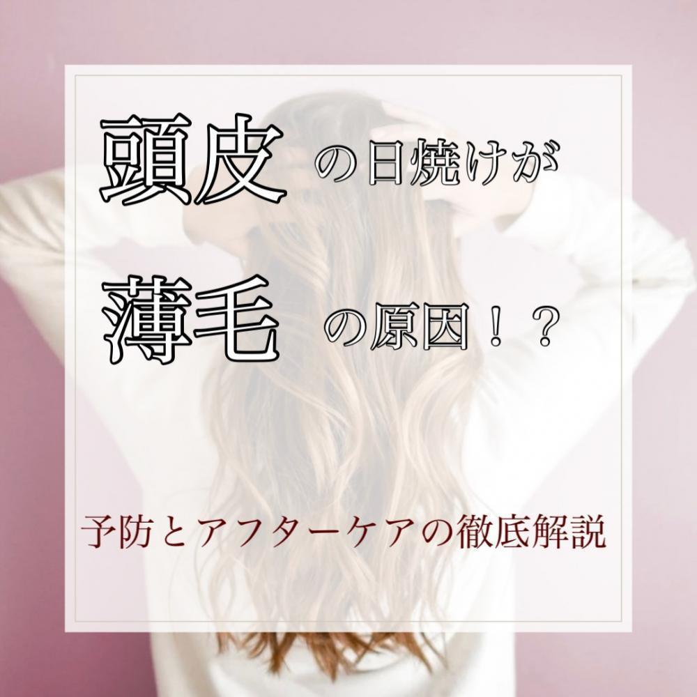 頭皮の日焼けは薄毛につながる！？予防からアフターケアまで徹底解説！！