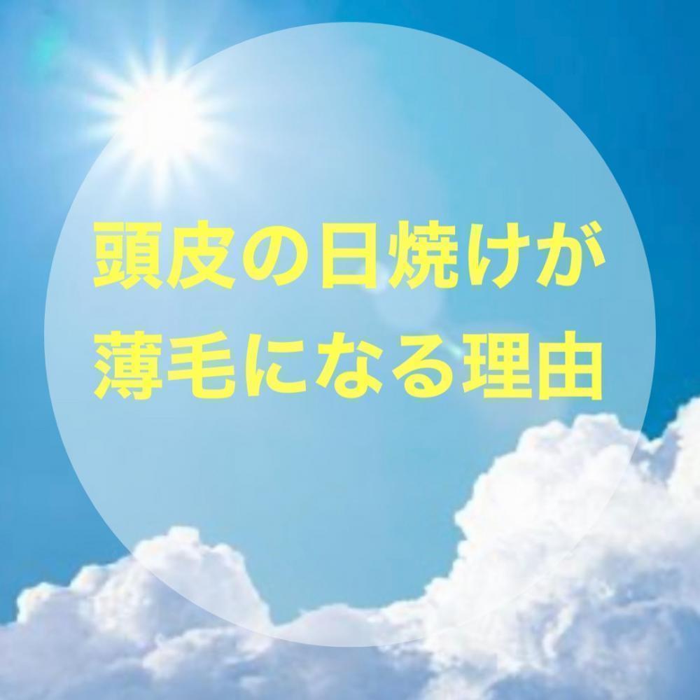 頭皮の日焼けが薄毛になる理由
