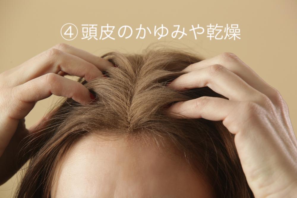④頭皮のかゆみや乾燥